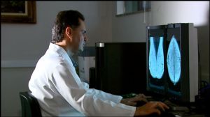 Medico analisa mamografia, em imagem de arquivo (Foto: Rodrigo Sargao/EPTV)